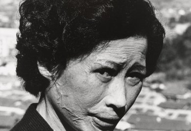 Christian, jolla on keloidisia arpia. 1961. Shomei Tomatsu. Lähde: Modernin taiteen museo